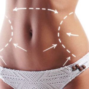 MESOTERAPIA CORPORAL Avilés