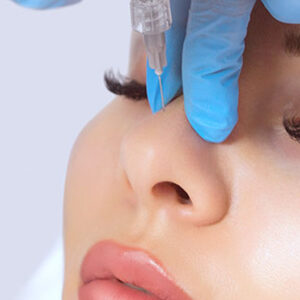 Rinoplastia - Cirugía estética Avilés